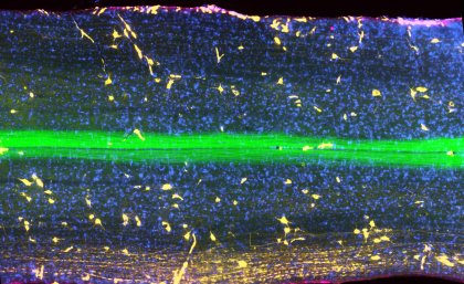 A slice through a spinal column showing the physical connection that links the brain to muscles. A slice through a spinal column showing the physical connection that links the brain to muscles.